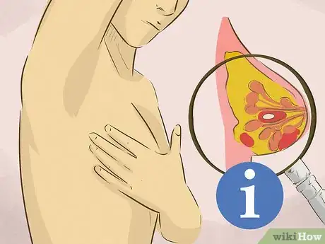 Imagen titulada Treat Breast Cysts Step 1