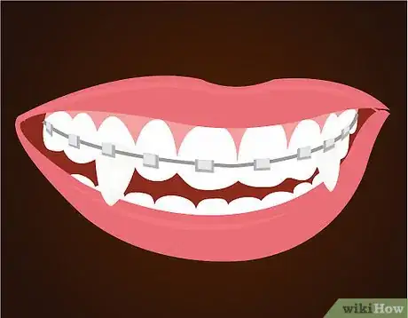 Imagen titulada Make Vampire Fangs if You Have Braces Intro