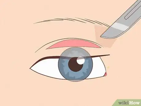 Imagen titulada Fix Asymmetrical Eyes Step 6