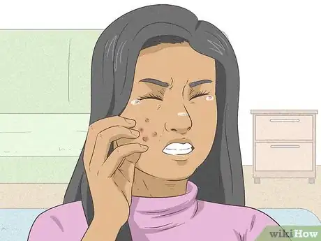 Imagen titulada Heal Your Face After Picking Step 13