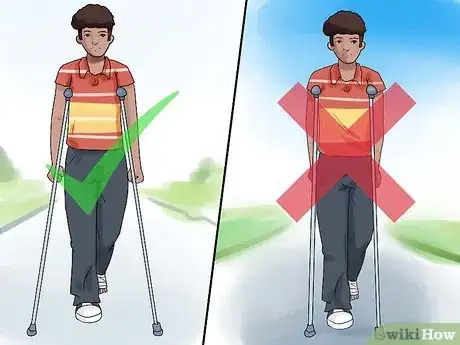 Imagen titulada Find Crutches Step 5