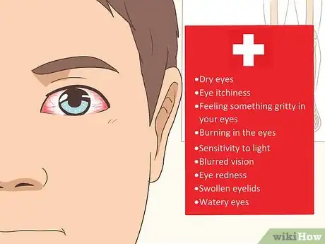 Imagen titulada Treat Ocular Rosacea Step 1