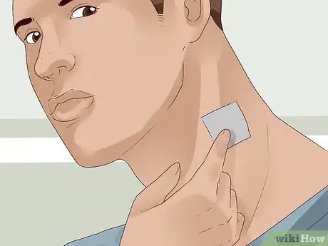 Imagen titulada Get Rid of Skin Tags Step 19