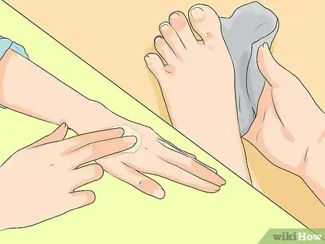 Imagen titulada Get Rid of Calluses Step 4