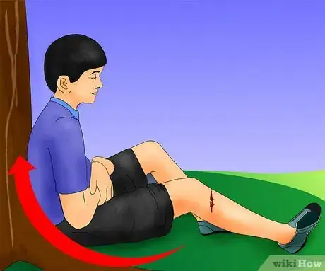 Imagen titulada Stop Bleeding Step 1