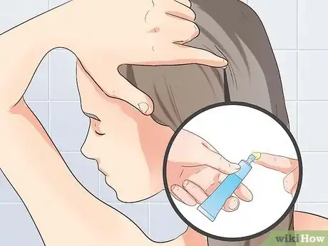 Imagen titulada Treat Scalp Pimples Step 5