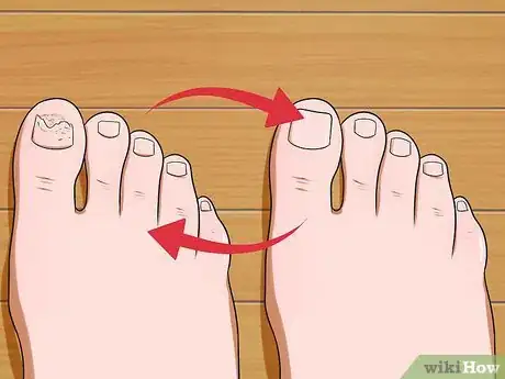 Imagen titulada Prevent Nail Fungus Step 13