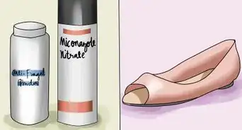 eliminar los hongos de las uñas de los pies (onicomicosis)