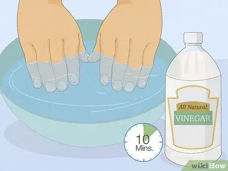 Imagen titulada Get Rid of White Spots on Your Nails Step 3