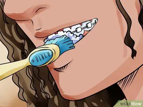 Imagen titulada Apply Dental Wax on Braces Step 6