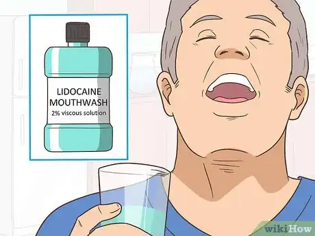 Imagen titulada Prevent a Cold Sore from Forming Step 17
