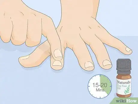 Imagen titulada Get Rid of White Spots on Your Nails Step 2