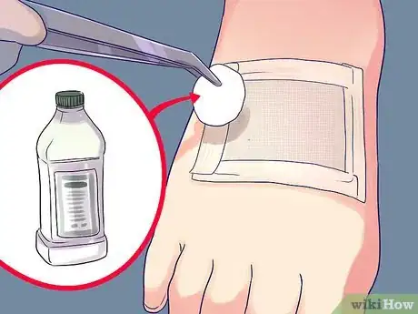 Imagen titulada Change a Wound Dressing Step 4