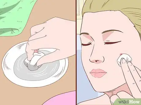 Imagen titulada Stop a Zit from Bleeding Step 1