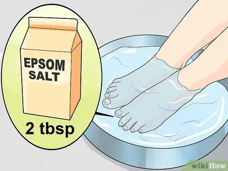 Imagen titulada Heal an Ingrown Toenail Step 1