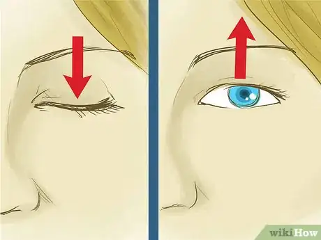 Imagen titulada Remove Something from Your Eye Step 1