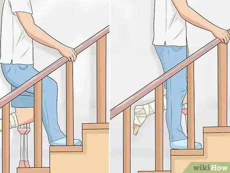 Imagen titulada Go Upstairs with Crutches Step 10