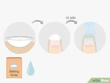 Imagen titulada Get Rid of Nail Fungus Step 4