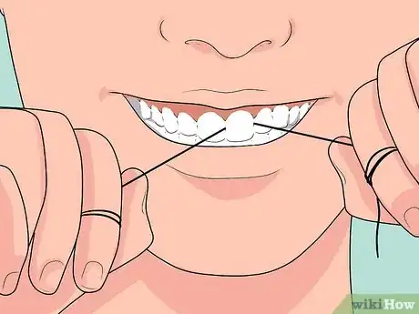 Imagen titulada Overcome Your Fear of the Dentist Step 15