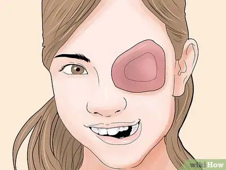 Imagen titulada Get Rid of a Lazy Eye Step 8