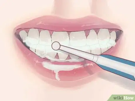 Imagen titulada Treat Gum Disease With Home Made Remedies Step 9