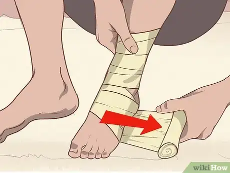 Imagen titulada Relieve Plantar Fasciitis Pain Step 10