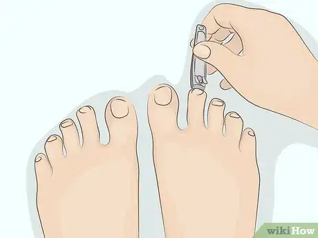 Imagen titulada Cure Onycholysis Step 15