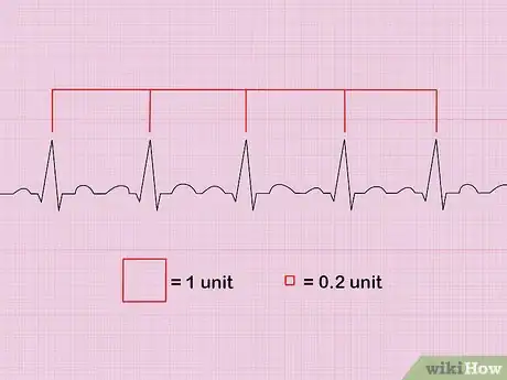 Imagen titulada Calculate Heart Rate from ECG Step 3