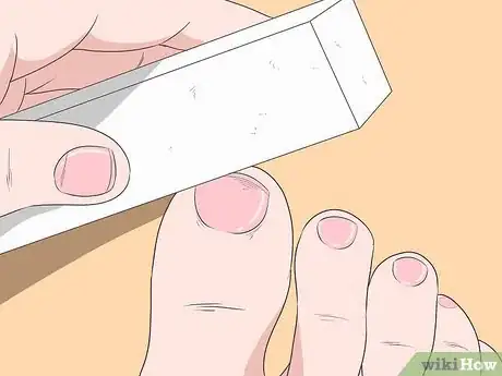 Imagen titulada Fix Thick Toenails Step 10