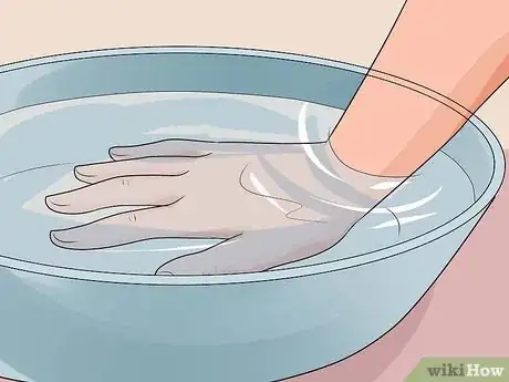 Imagen titulada Treat a Hot Water Spill on Your Skin Step 8