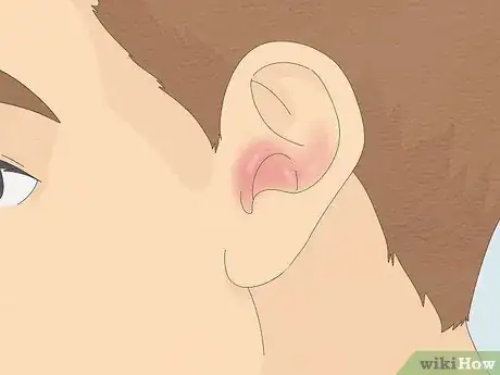 Imagen titulada Remove a Bug from Your Ear Step 13
