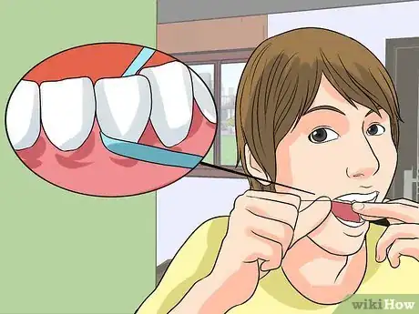 Imagen titulada Remove Yellow Between the Teeth Step 1