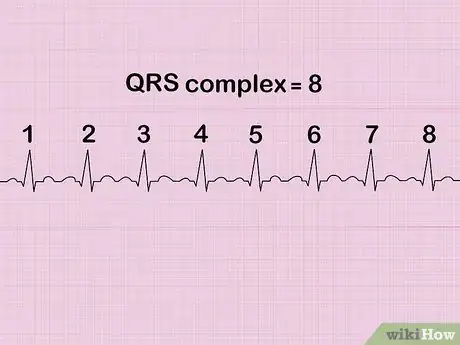 Imagen titulada Calculate Heart Rate from ECG Step 6