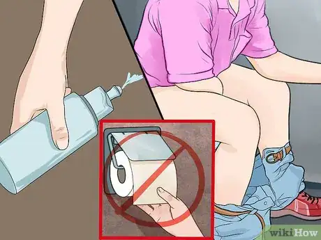 Imagen titulada Treat Hemorrhoids After Pregnancy Step 5