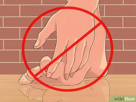 Imagen titulada Get Rid of Plantar Warts (Verrucas) Step 17