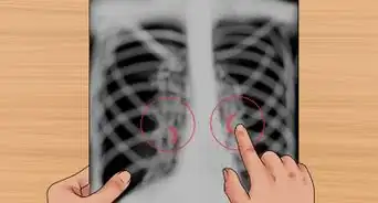 interpretar una radiografía de tórax