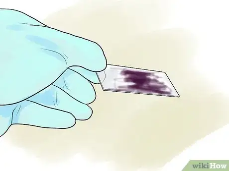 Imagen titulada Gram Stain Step 11