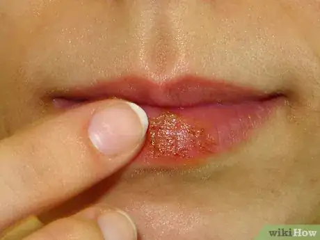 Imagen titulada Make Your Own Lip Plumper at Home Step 15