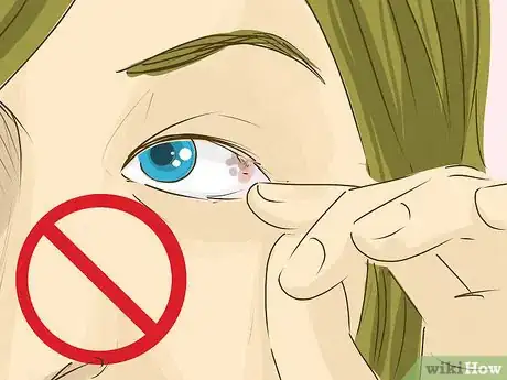 Imagen titulada Remove Something from Your Eye Step 11