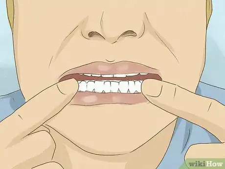 Imagen titulada Get Whiter Teeth at Home Step 3