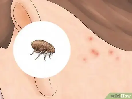 Imagen titulada Identify Insect Bites Step 6