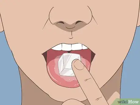 Imagen titulada Soothe Inflamed Taste Buds Step 1