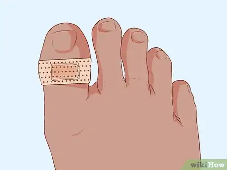 Imagen titulada Bandage Fingers or Toes Step 11