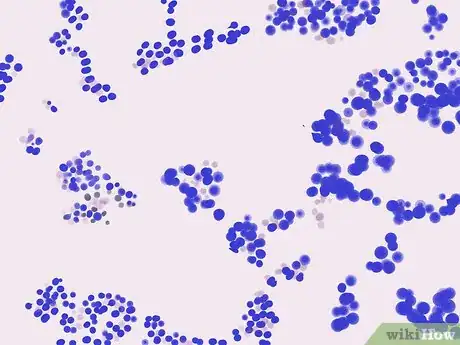 Imagen titulada Gram Stain Step 15