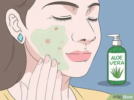 Imagen titulada Get Rid of a Blind Pimple Step 4