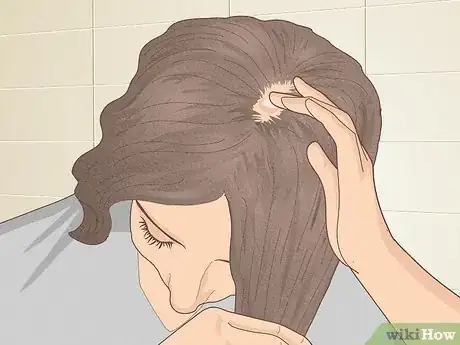 Imagen titulada Bumps on Scalp Step 6