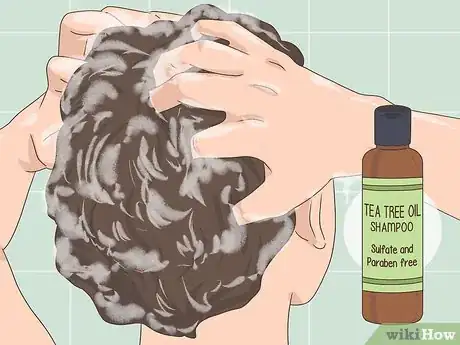 Imagen titulada Get Rid of Dandruff Step 7