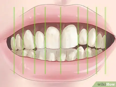 Imagen titulada Tell if You Have Mouth Cancer Step 5