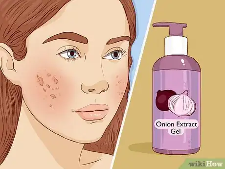 Imagen titulada Take Care of Your Skin With Natural Methods Step 13