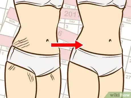 Imagen titulada Get Rid of Stretch Marks on Your Back Step 3